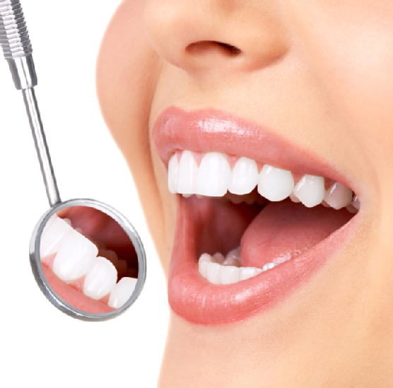 Dental Implants Las vegas